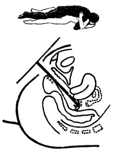 Thighs of the sex doll lying open and slightly bent and drawn to the breast or bent with the legs thrown over the man's shoulders - variant 1