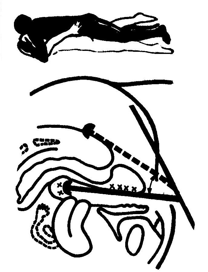 The lying back position, in which the sex doll is lying on the stomach - variant 2